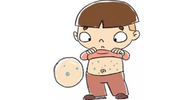 丘疹性荨麻疹传染吗